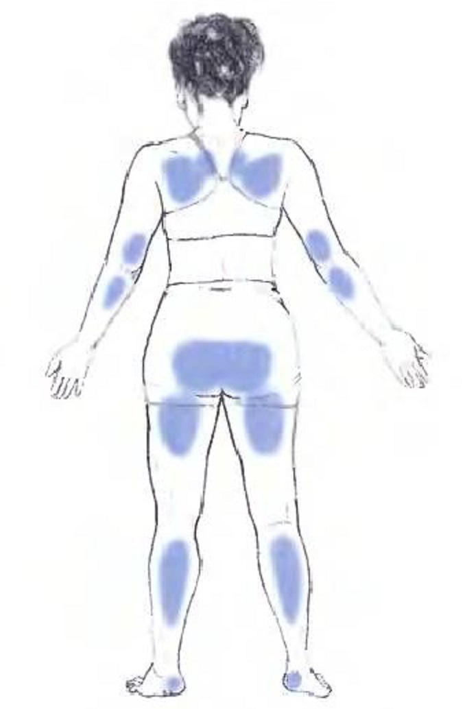 Шавасана – поза для отдыха и аутотренинга